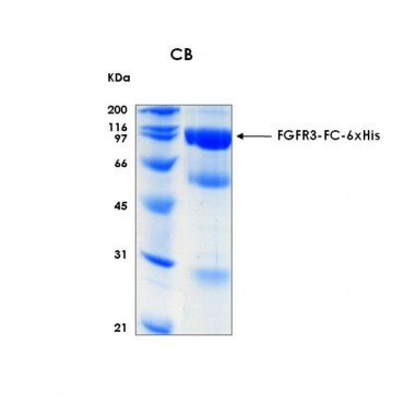 Human FGFR3 (Fibroblast growth factor receptor 3) extracellular domain, Fc and 6xHis tag, 100 ug