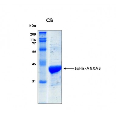 Human ANXA3 (Annexin A3), 6xHis tag, 50 ug
