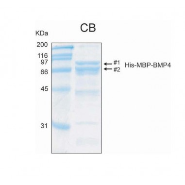 Human BMP4 (Bone morphogenetic protein 4), His-MBP tags, 100 ug