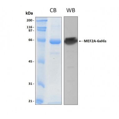 Human MEF2A from E.coli, 6xHis tag, 25 ug